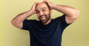 A man holding his bald head sporting a smiling expression - showcasing a concept of male pattern baldness