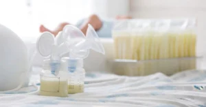 Expressed breast milk stored in bottles and bags after pumping.